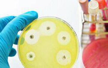 Ai e medicina di precisione per combattere super batteri resistenti lo studio italiano su quasi 10.000 pazienti 364x230