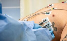 Caldo disidratazione e sbalzi pressori ecco le 10 regole per proteggere la salute del cuore 265x160