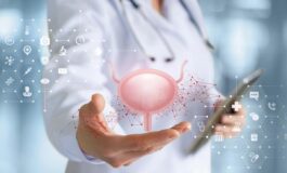 Cancro alla vescica approvato rimborso per immunoterapia prima e dopo chirurgia 265x160