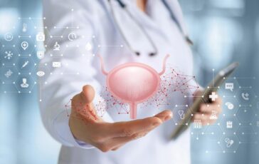 Cancro alla vescica approvato rimborso per immunoterapia prima e dopo chirurgia 364x230
