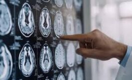 Centro Dbs Pavia 100 interventi di neurostimolazione profonda per Parkinson 265x160