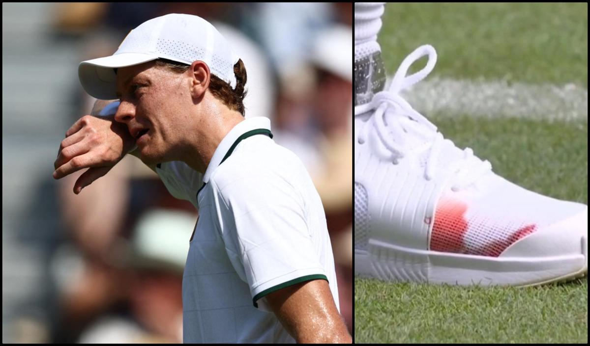 Sinner: "Scarpa insanguinata? Era solo un'unghia..."