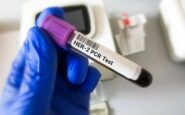 tumore gastroesofageo her2 risultati positivi per tislelizumab con zanidatamab e chemio 2