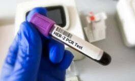 Tumore gastroesofageo Her2 risultati positivi per tislelizumab con zanidatamab e chemio 265x160