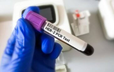tumore gastroesofageo her2 risultati positivi per tislelizumab con zanidatamab e chemio 2