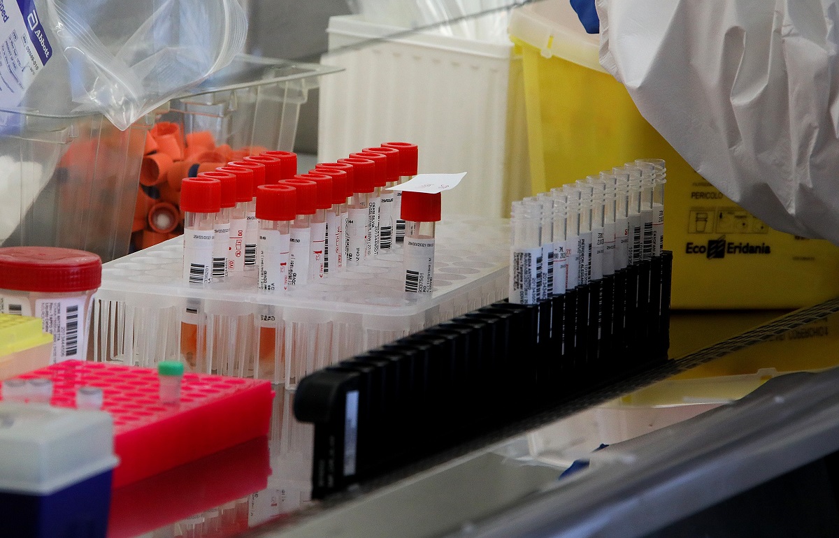 Dal mal di testa alla diarrea: i sintomi dell’Ebola Bundibugyo e la trasmissione del virus