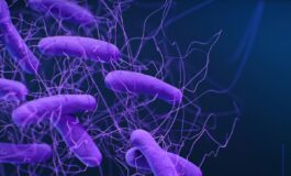 legionella Italia