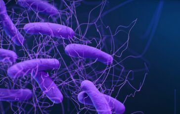 legionella Italia