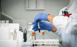 Alzheimer nuovo test del sangue potrebbe prevedere sintomi imminenti 265x160