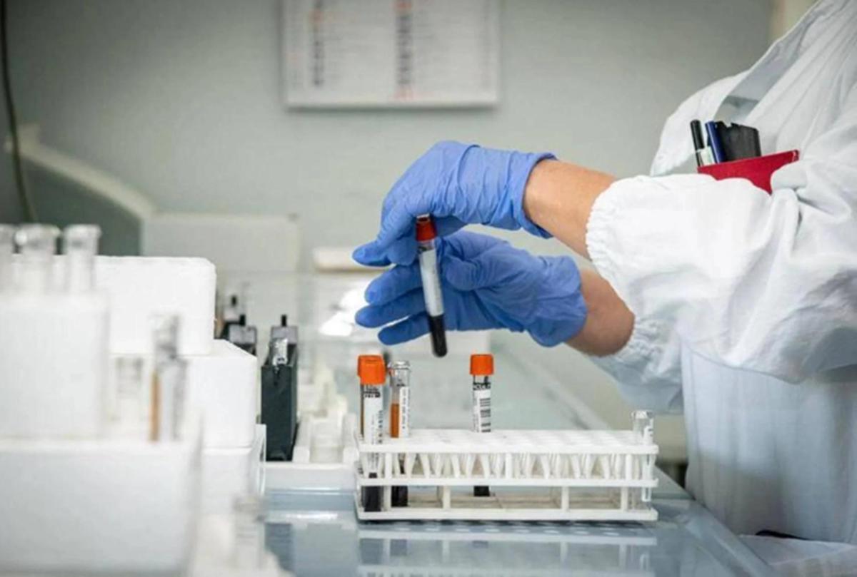 Alzheimer, nuovo test del sangue potrebbe prevedere sintomi imminenti