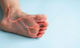 Asl Roma 4 presentato nuovo Pdta per neuropatia diabetica dolorosa 265x160