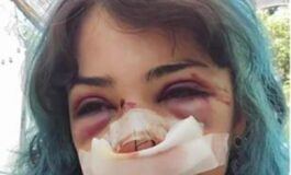 Bari studentessa picchiata al parco indagati per lesioni e rapina custode bagni e il compagno 265x160