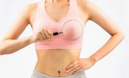 Cancro seno triplo negativo a Cosenza confronto sulla presa in carico delle pazienti 265x160