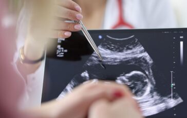 Chirurgia si rompe laorta e viene operata con il bimbo in utero intervento record a Milano 364x230