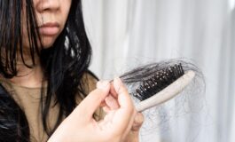 Con nuovi farmaci anti diabete e obesita piu rischi di perdere i capelli lo studio 265x160