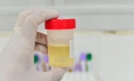 Dai segnali del colore alla postura sui social e urina mania tra scienza e falsi miti 265x160