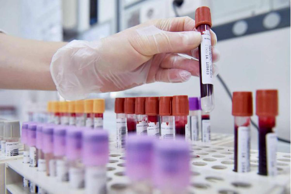 Dal microbiota una speranza contro l'epilessia resistente, lo studio italiano