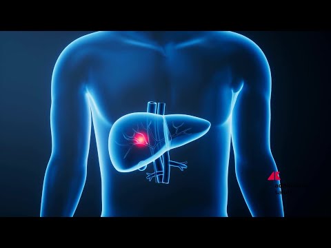 Giornata epatiti, esperti ‘terapie efficaci, screening di prossimità per le virali’