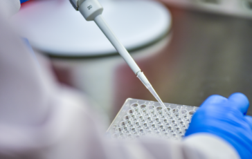 Giornata mondiale della malattia di Sjogren esperti Non sono solo occhi secchi 364x230