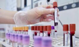 Hiv dalla Sicilia il modello per estendere terapie long acting 265x160