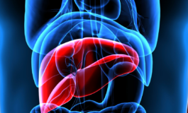 Mash esperti a confronto su importanza diagnosi per patologia epatica sottovalutata 265x160