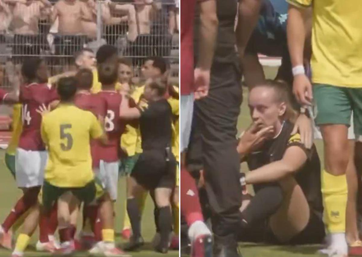 Rissa nel match amichevole, l'arbitra finisce k.o.