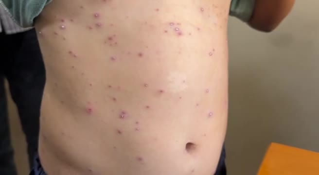 Campo profughi affollato a Gaza con baracche, persone sedute a terra tra condizioni igieniche precarie, immagine di approfondimento