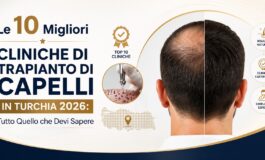 6a620b27de492 le 10 migliori cliniche di trapianto di capelli in turchia 2026 1 265x160