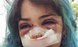 Bari studentessa picchiata nei bagni denuncia nuovo episodio Mi hanno accerchiata 265x160