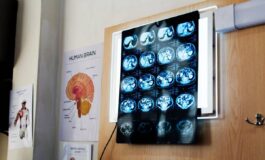 Di Battista cosa indica un mal di testa forte e improvviso le ipotesi del neurologo 265x160