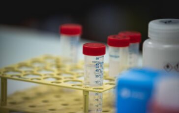 Difterite quali rischi Dalla trasmissione alla vaccinazione ecco cosa sapere 364x230