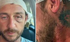 Io aggredito a sassate in Sardegna da 30 persone perche gay la denuncia sui social ﻿ 265x160