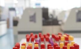 Malaria in aeroporto in Germania gli esperti Campanello dallarme ma il rischio resta contenuto 265x160