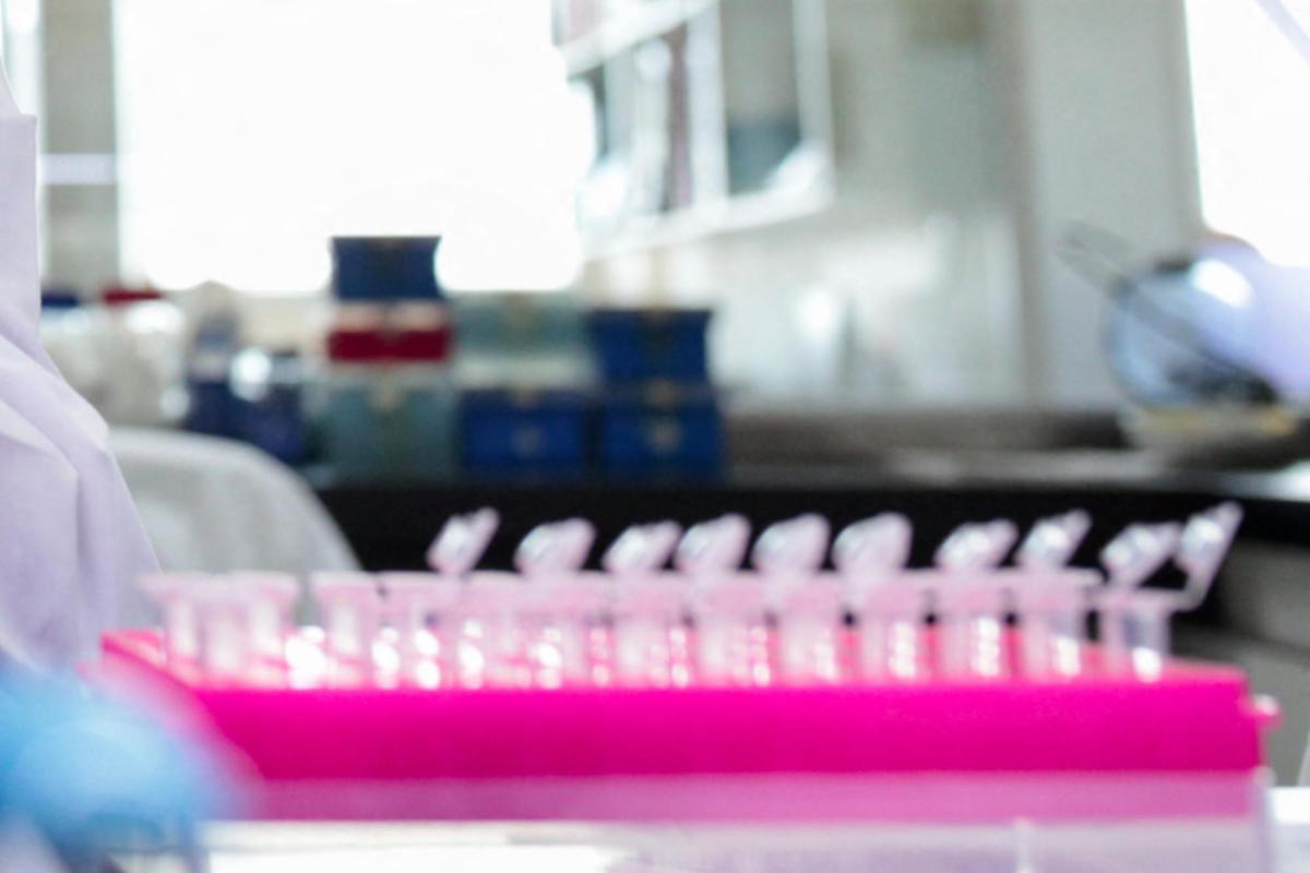 Milano, focolaio di tubercolosi all'Istituto di Medicina legale: 8 casi conclamati e 7 positivi. Indagini sull'origine del contagio