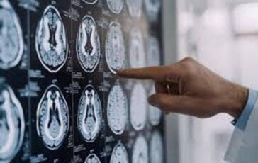 Parkinson in Italia 300mila persone malate 10 ha diagnosi prima dei 50 anni 364x230