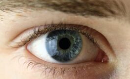 Trapianti innesto di cornea ad alto rischio intervento riuscito al Bambino Gesu 265x160