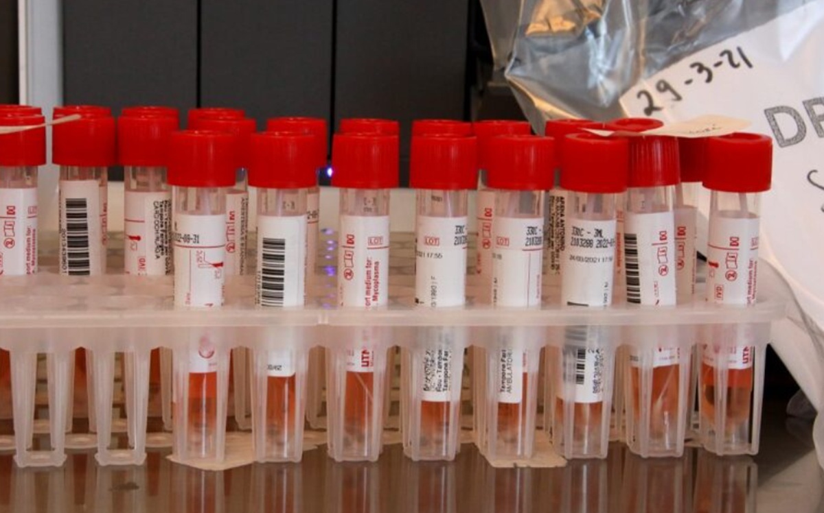https://static.adhubmedia.com/notizie_it/wp-content/uploads/2026/08/ebola-congo-588fbd3b.jpg