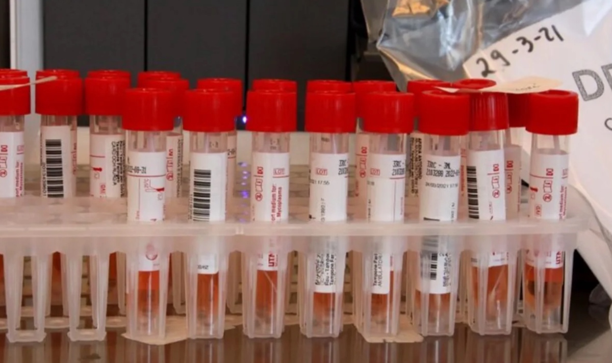 Ebola in Congo, l'OMS: "Come può evolversi l'epidemia"