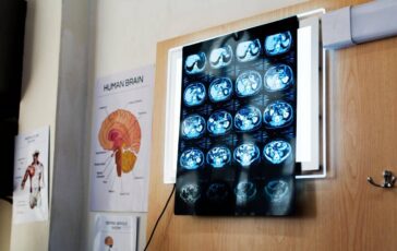 11 anni di chemio per un tumore che non cera la diagnosi sbagliata e lincubo 364x230