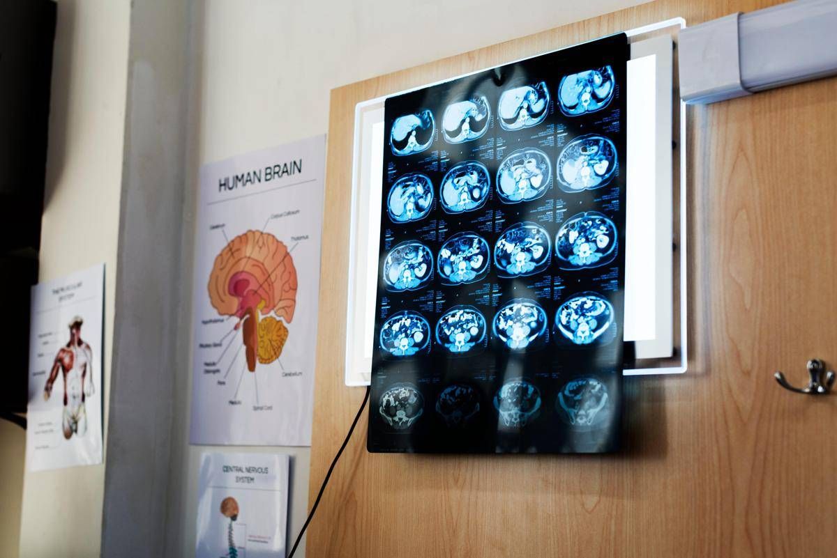"11 anni di chemio per un tumore che non c'era", la diagnosi sbagliata e l'incubo