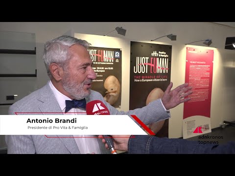 Brandi (Pro Vita): “Mostra ‘Just Euman’ per mostrare che la vita comincia al concepimento”