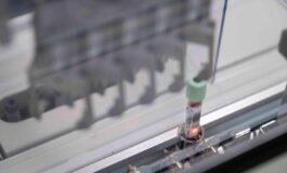 Cancro del pancreas allo studio test del sangue per la diagnosi precoce 265x160