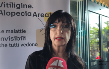 Cassia Aipaf Con nuove terapie Ssn riconosca alopecia per sostenere i pazienti 364x230