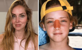 Chiara Ferragni lintervento al naso Ecco perche e storto ora 265x160