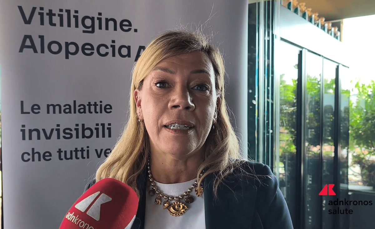 Cordella (AbbVie): "Vitiligine e alopecia siano riconosciute da Ssn"