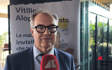 Costanzo Sidemast Upadacitinib blocca cellule infiammatorie in vitiligine e alopecia areata 364x230