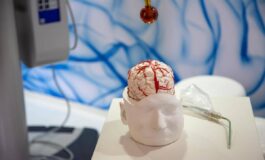 Dai gliomi al Parkinson cosi lintelligenza artificiale aiuta la Neurochirurgia 265x160