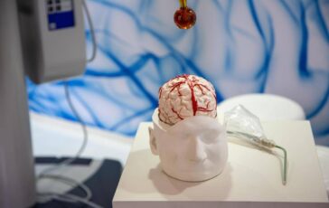 Dai gliomi al Parkinson cosi lintelligenza artificiale aiuta la Neurochirurgia 364x230