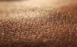 Dermatite atopica quando la pelle condiziona la vita Diari atipici da voce ai pazienti 265x160