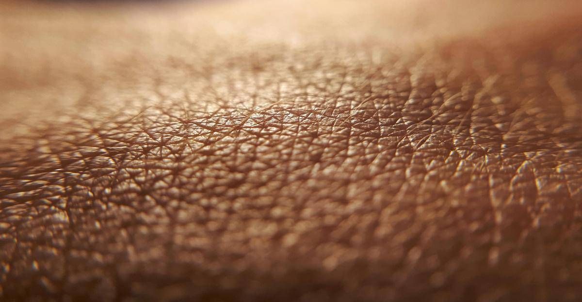 Dermatite atopica, quando la pelle condiziona la vita, 'Diari atipici' dà voce ai pazienti